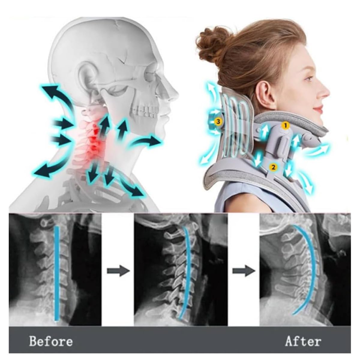 Neck brace device showing before and after effects on a skeleton and person.
