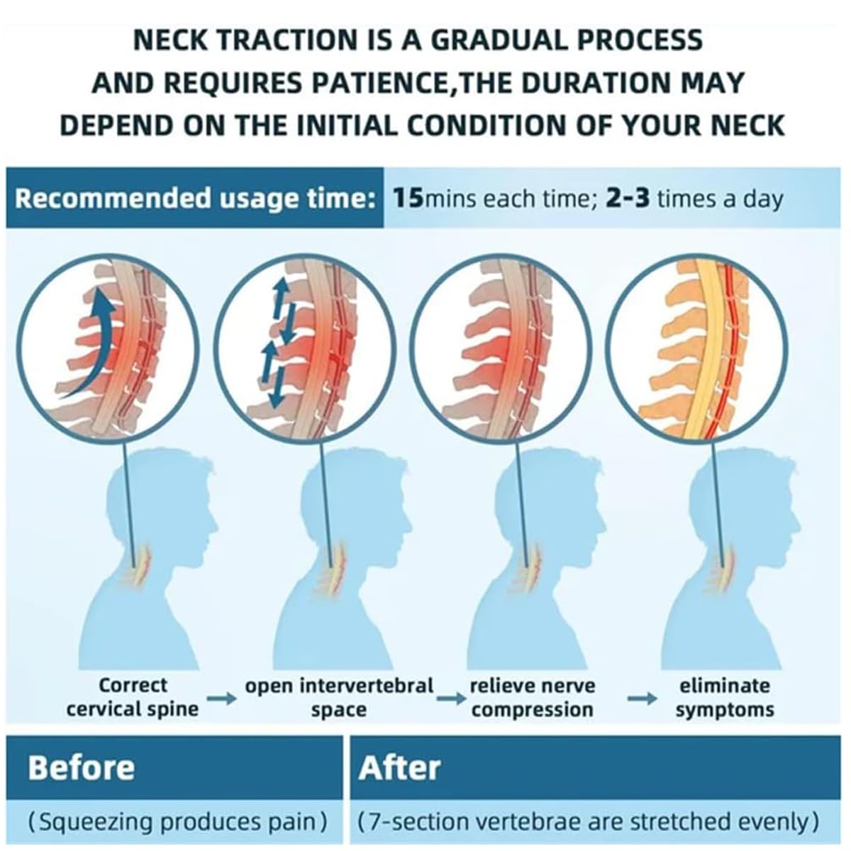 Diagram showing neck traction process with before and after effects on a neck.